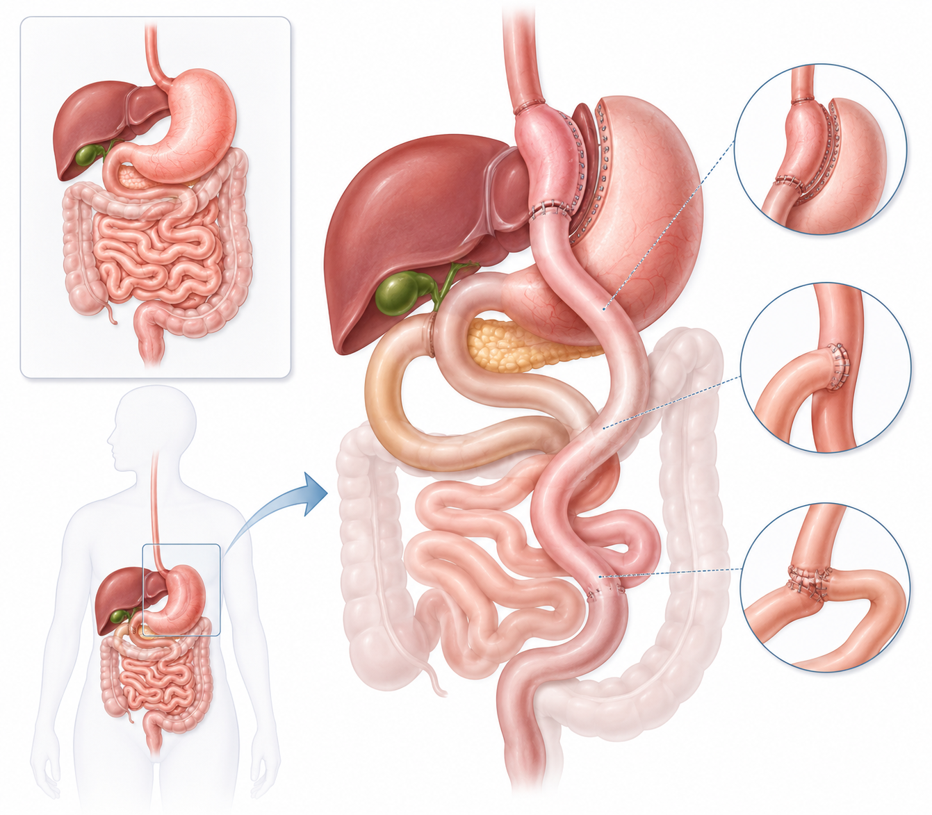 Dr. Nikunj Jain, best hernia doctor in Indore, best laparoscopic surgeon in Indore, hernia treatment in Indore, piles treatment in Indore, piles doctor in Indore, best piles doctor in Indore, gastroenterologist in Indore, weight loss clinic in Indore, weight loss doctor in Indore, best weight loss doctor in Indore, best bariatric surgeon in Indore, bariatric doctor in Indore, best weight loss surgeon in Indore