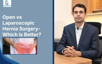Open vs Laparoscopic Hernia Surgery – Which Is Better?