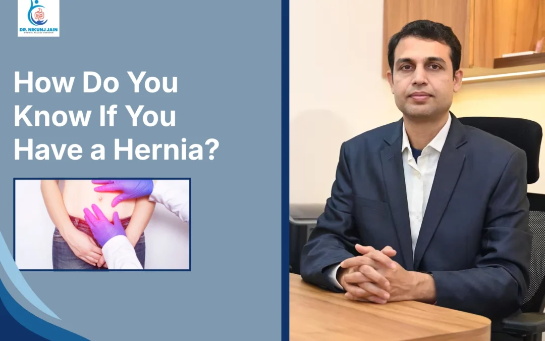 How Do You Know If You Have a Hernia?