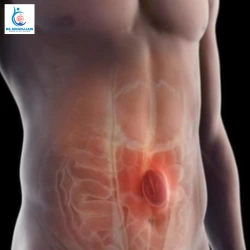 Is Hernia Surgery Always Necessary 2