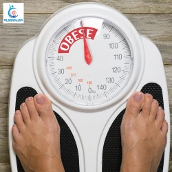 Obesity and PCOS How Bariatric Surgery Can Help 2 1