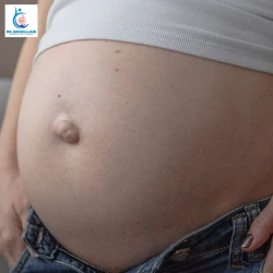 What Happens If a Hernia Is Left Untreated? What Happens If a Hernia Is Left Untreated 2