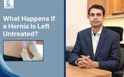 Best Laparoscopic Surgeon in Indore What Happens If a Hernia Is Left Untreated?