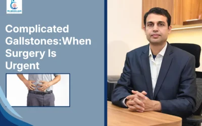 Best Laparoscopic Surgeon in Indore Complicated Gallstones: When Surgery Is Urgent