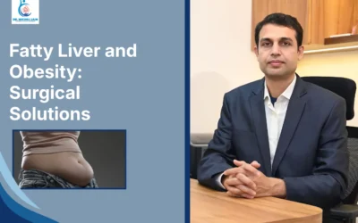 Best Laparoscopic Surgeon in Indore Fatty Liver and Obesity: Surgical Solutions