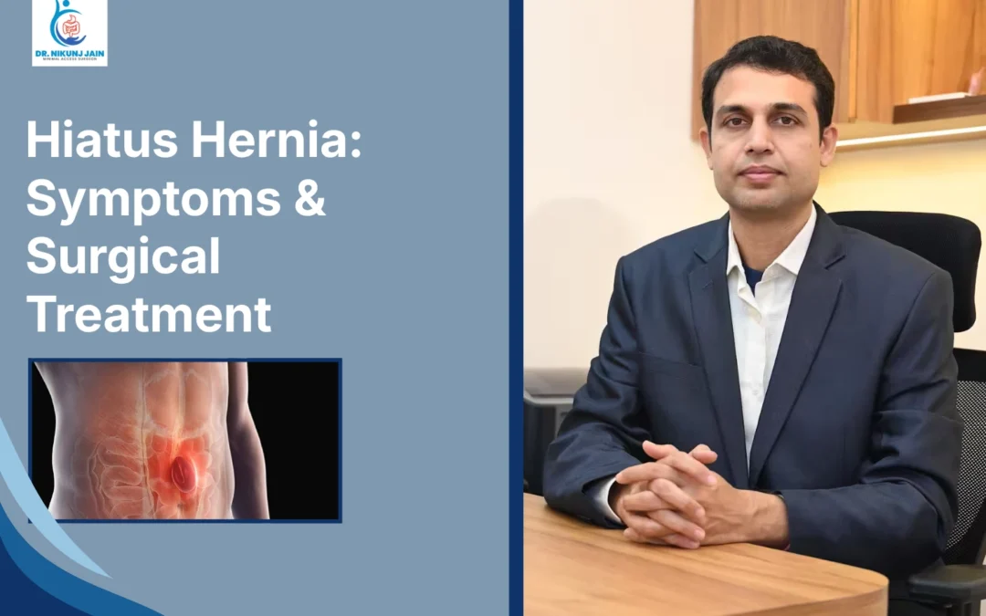 hiatus hernia treatment in Indore, hiatus hernia surgery in Indore, gastro surgeon in Indore, laparoscopic surgeon in Indore, acid reflux treatment in Indore, GERD treatment in Indore, heartburn treatment in Indore, best hernia surgeon in Indore, stomach hernia doctor in Indore, reflux surgery in Indore, laparoscopic reflux surgery Indore, hiatus hernia specialist Indore, gastroenterologist surgeon Indore, digestive disorder treatment Indore, acidity treatment in Indore, chest burning treatment Indore, swallowing difficulty treatment Indore, endoscopy doctor in Indore, laparoscopic hernia repair Indore, stomach specialist in Indore, reflux specialist Indore, hiatal hernia doctor Indore, best gastroenterologist surgeon in Indore, Dr Nikunj Jain Indore, hernia treatment Vijay Nagar Indore, gastro surgery clinic Indore, advanced laparoscopic surgery Indore, stomach acid reflux doctor Indore, hernia surgery near me Indore, digestive health specialist Indore