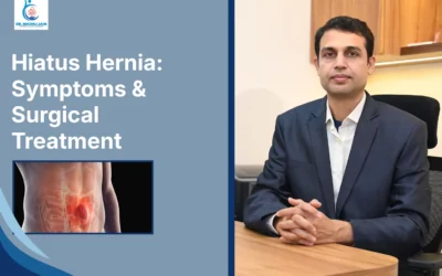 Best Laparoscopic Surgeon in Indore Hiatus Hernia: Symptoms & Surgical Treatment