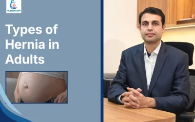 Best Laparoscopic Surgeon in Indore Types of Hernia in Adults