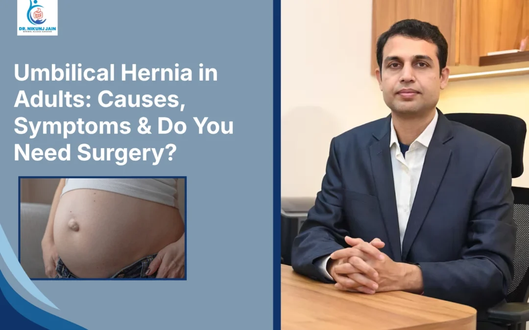Umbilical hernia in adults, umbilical hernia symptoms, umbilical hernia treatment, umbilical hernia surgery, umbilical hernia surgeon in Indore, umbilical hernia treatment Indore, best hernia surgeon in Indore, best gastroenterologist surgeon in Indore, Dr. Nikunj Jain Indore, laparoscopic umbilical hernia surgery, minimally invasive hernia surgery, hernia specialist Indore, abdominal wall hernia treatment, belly button hernia treatment, umbilical hernia repair, mesh hernia surgery Indore, general surgeon for hernia Indore, GI surgeon Indore, gastro surgeon Indore, laparoscopic surgeon Indore, hernia doctor in Indore, hernia consultation Indore, hernia operation Indore, abdominal hernia treatment Indore, robotic hernia surgery Indore, adult umbilical hernia treatment, painless hernia surgery Indore, advanced hernia surgery Indore, hernia treatment near me, hernia hospital Indore.