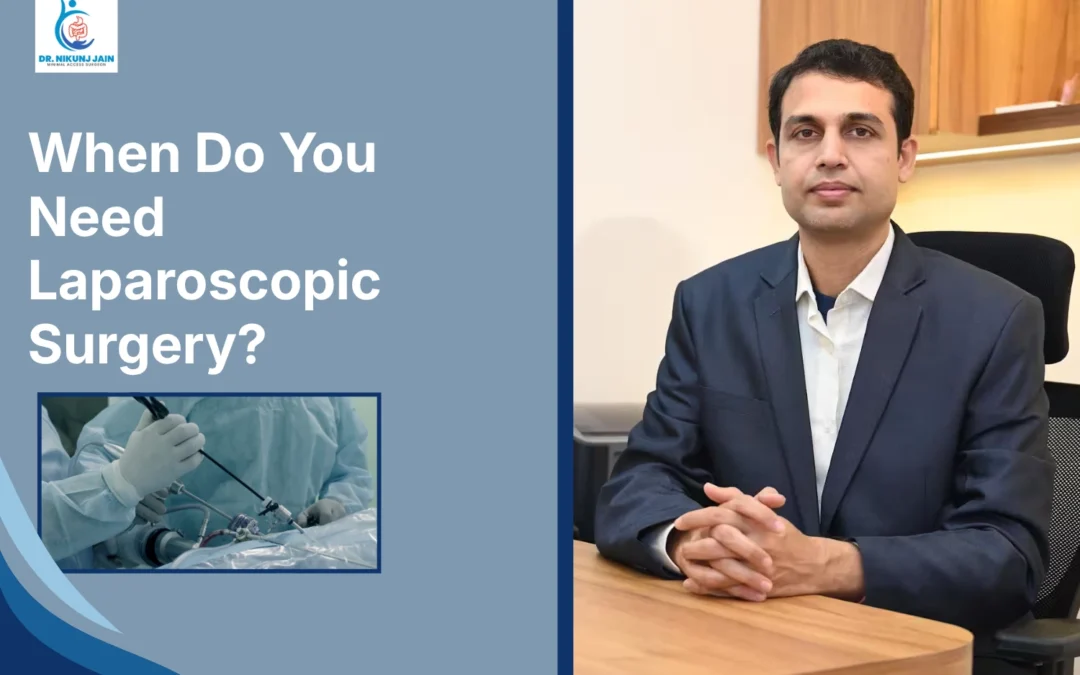 When Do You Need Laparoscopic Surgery?, laparoscopic surgery in Indore, laparoscopic surgeon in Indore, minimally invasive surgery Indore, keyhole surgery in Indore, best laparoscopic surgeon Indore, laparoscopic surgery doctor Indore, general surgeon in Indore, advanced laparoscopic surgery Indore, laparoscopic clinic Indore, hernia surgery in Indore, laparoscopic hernia repair Indore, gallbladder surgery Indore, gallstone surgery Indore, laparoscopic gallbladder removal Indore, appendix surgery Indore, laparoscopic appendix surgery Indore, bariatric surgery Indore, weight loss surgery Indore, obesity surgeon Indore, abdominal surgery Indore, minimally invasive surgeon Indore, keyhole surgeon Indore, laparoscopic treatment Indore, general surgery specialist Indore, hernia specialist Indore, gallstone specialist Indore, appendix specialist Indore, surgical consultation Indore, laparoscopic hospital Indore, advanced surgery Indore, painless surgery Indore, small incision surgery Indore, faster recovery surgery Indore, laparoscopic treatment near me