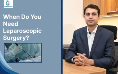 Best Laparoscopic Surgeon in Indore When Do You Need Laparoscopic Surgery?