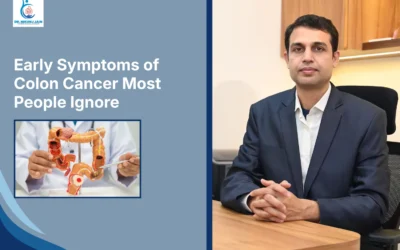 Early Symptoms of Colon Cancer Most People Ignore