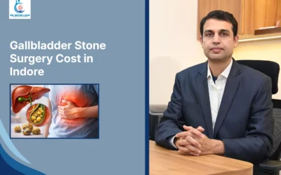 Blogs Gallbladder Stone Surgery Cost in Indore