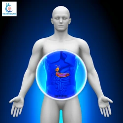 Gallbladder Stone Surgery Cost in Indore￼