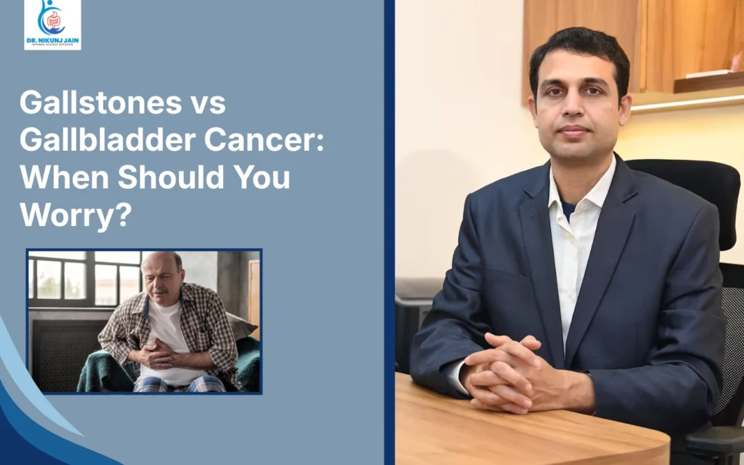 Gallstones vs Gallbladder Cancer: When Should You Worry?