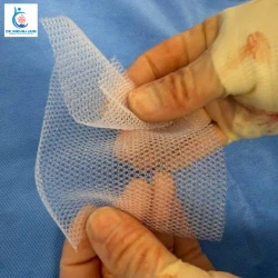 Hernia Mesh Surgery Myths vs Facts Patients Should Know 2
