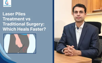 Laser Piles Treatment vs Traditional Surgery: Which Heals Faster?