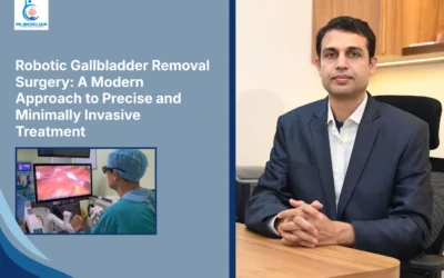 Robotic Gallbladder Removal Surgery : A Modern Approach to Precise and Minimally Invasive Treatment
