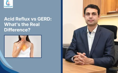 Best Laparoscopic Surgeon in Indore Acid Reflux vs GERD: What’s the Real Difference?
