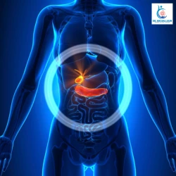 Stomach Pain After Eating Oily Food: Could It Be Gallstones? Stomach Pain After Eating Oily Food Could It Be Gallstones 1