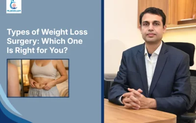 Best Laparoscopic Surgeon in Indore Types of Weight Loss Surgery: Which One Is Right for You?
