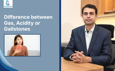 Best Laparoscopic Surgeon in Indore Difference between Gas, Acidity or Gallstones