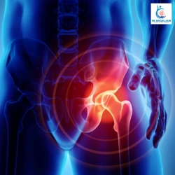 Groin Pain Without a Visible Lump Can It Still Be a Hernia