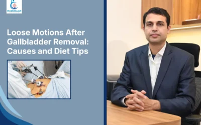 Best Laparoscopic Surgeon in Indore Loose Motions After Gallbladder Removal: Causes and Diet Tips