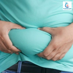 Repeated Diet Failure and Obesity Treatment in Indore 2