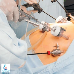 Robotic Hernia Surgery in Indore: Benefits, Cost and Patient Selection Robotic Hernia Surgery in Indore Benefits Cost and Patient Selection